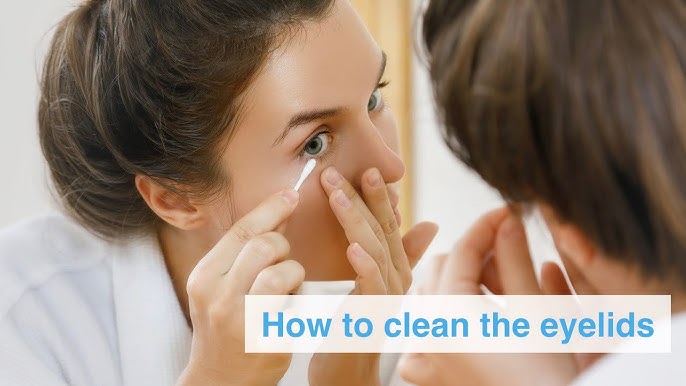 How to Clean My Eyelids