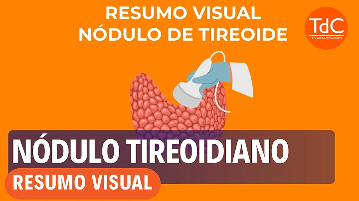 Resumo Visual: 7 Armadilhas de Ndulo Tireoidiano f...