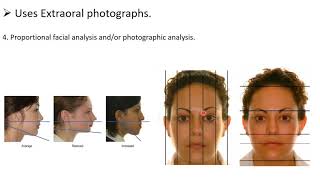 Diagnostic Records Study Models And Photographs   Part 2 1 screenshot 5