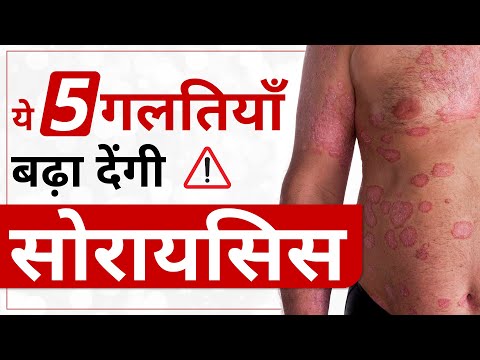 5 गलतियाँ जो बढ़ा सकती आपका सोरायसिस | Ayurvedic Cure for Psoriasis | Dr. Himanshu Dhawan