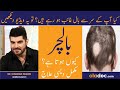 Baalchar ka elaj  alopecia areata symptoms  treatment urdu  alopecia ka ilaj  patchy hair loss