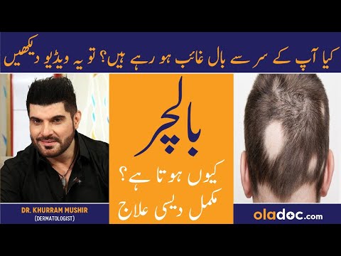 Baalchar Ka Elaj - Alopecia Areata Symptoms & Treatment Urdu - Alopecia Ka  Ilaj - Patchy Hair Loss - YouTube