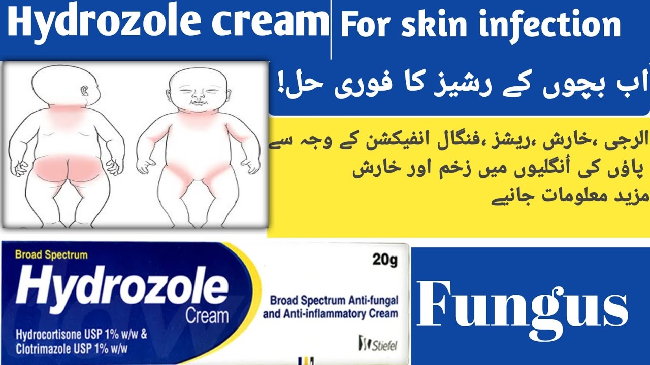 Hydrozole cream full detail in Urdu How to use Hydrozole cream for skin