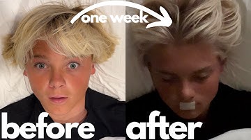 How To Fix Your Sleep (PROVEN Step By Step Guide)
