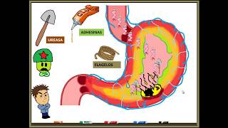 HELICOBACTER PYLORI, GASTRITIS