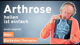 Arthrose verstehen und behandeln: Schmerzfreiheit trotz Arthrose - Die besten Therapieansätze