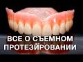 Cъемное протезирование. Что такое съемные протезы? В каких случаях используют протезирование?