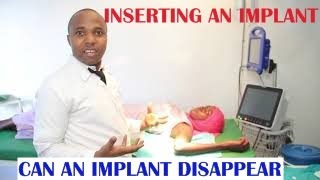 HOW DOES AN IMPLANT WORK what are d side effects of a contraceptive implant, is it a hormonal method