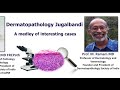 Under my scope 2021 edition webinar5 dermatology jugalbandi 30jan2021