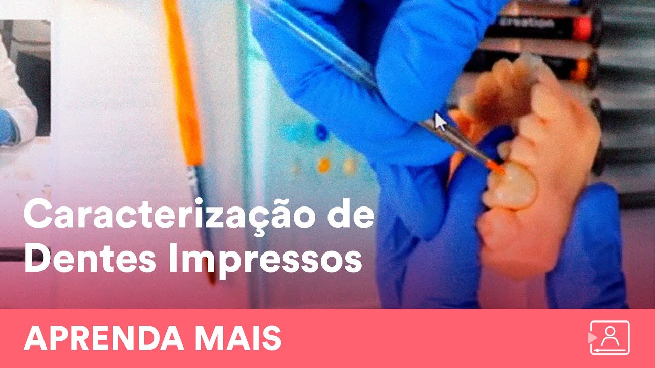 Maquiagem de Dentes Provisórios confeccionados por Impressão 3D: (PARTE 2 | Na Prática)
