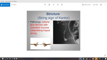 # GIT PASSMEDICINE NOTES READING 4 MRCP - PART ONE