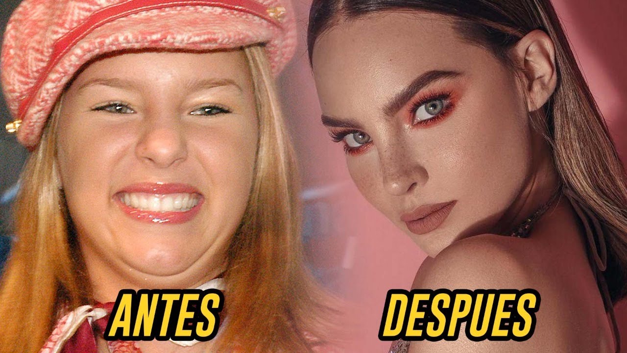 BELINDA | MÉDICO REACCIONA A CIRUGIAS DE FAMOSOS