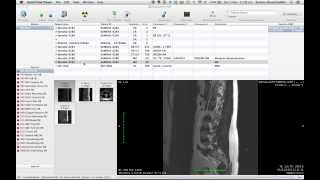 Tutorial 021 OsiriX How to Edit Series Number