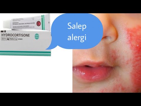 Salep Kulit hydrocortisone acetate untuk mengobati ruam kulit akibat berbagai alergi/dermatitis