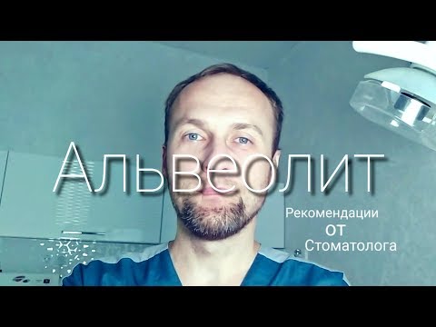 Рекомендации После Удаления Зуба. Альвеолит