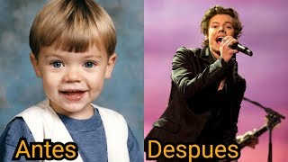 Harry Styles Antes Y Despues (Before and After)2017