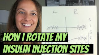 How I Rotate My Insulin Injection Sites