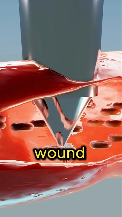 Should You Let Wounds Dry Out? 🚫💦 (Wound Healing Explained) #shorts #viral #woundcare
