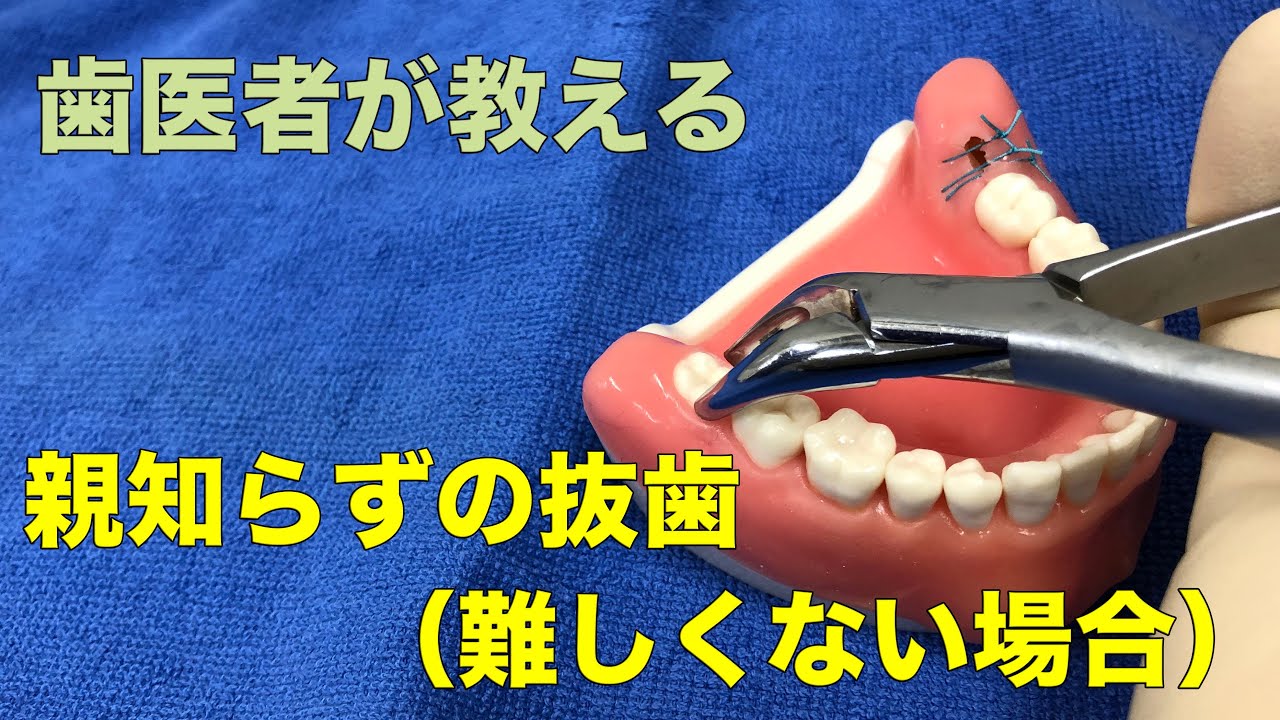 親知らず抜歯感想 インプラントなら神奈川県横浜市の医療法人横浜歯友会内藤歯科