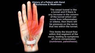 Carpal Tunnel Syndrome  symptoms and treatment  Everything You Need To Know  Dr. Nabil Ebraheim