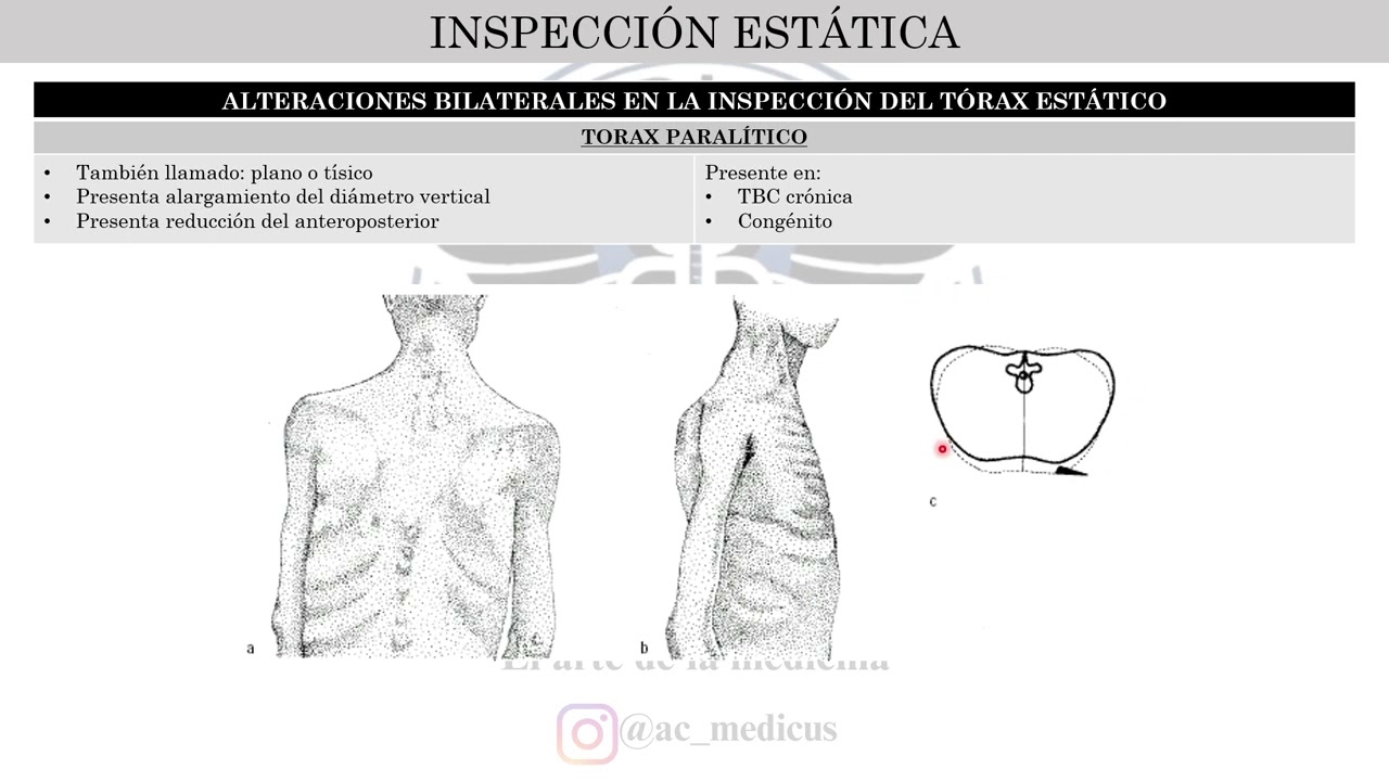 CICLO VERANO 2025 – SEMIOLOGÍA MÉDICA – SEMANA N°4 - EXP. FISICA DE TÓRAX RESPIRATORIO