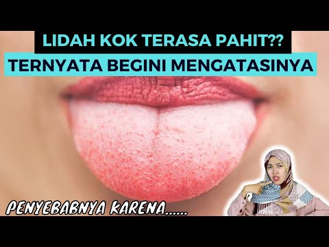PENYEBAB DAN CARA MENGATASI MENGOBATI LIDAH TERASA PAHIT