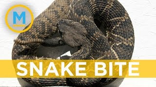 Man bitten by severed snake head | Your Morning