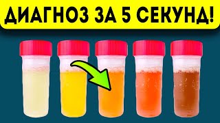 Утренняя моча подскажет, какой из органов выходит из строя: цвет, запах и …