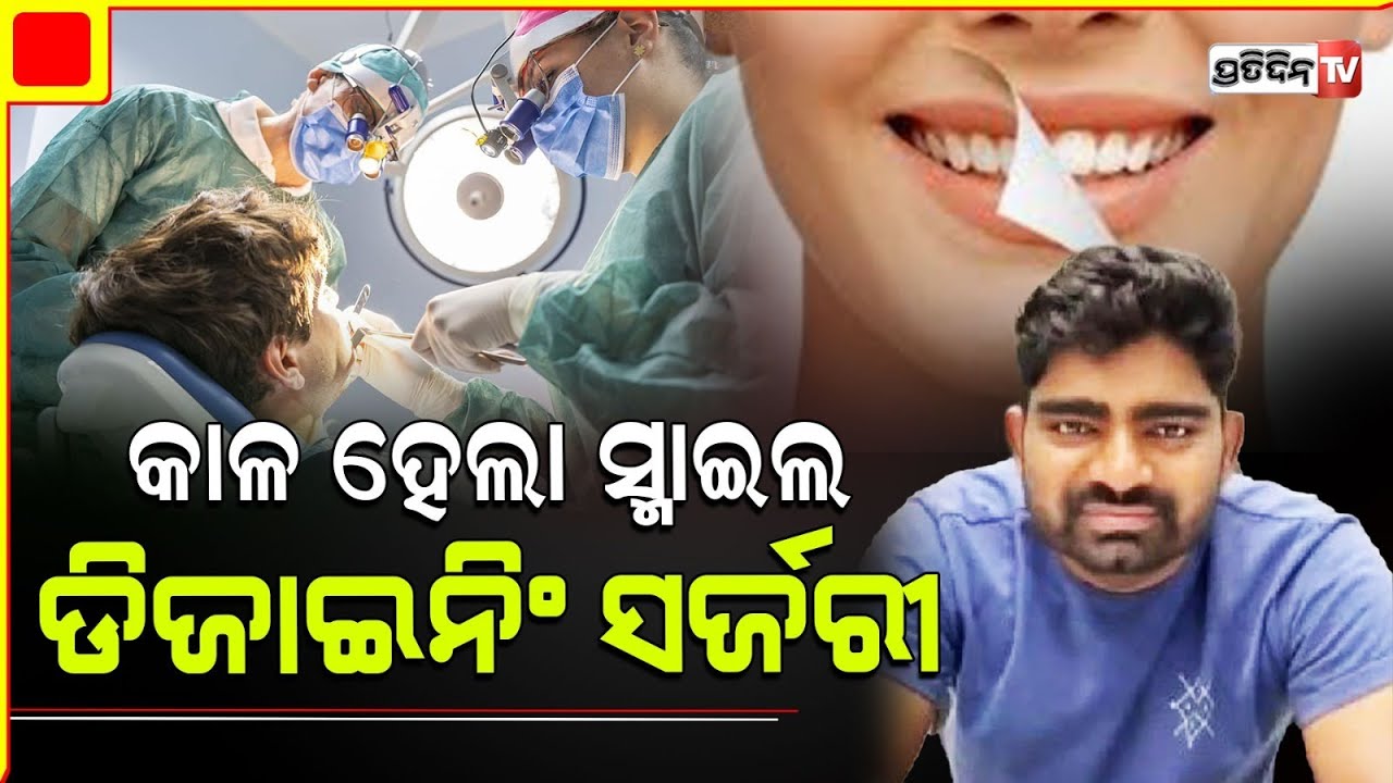 ମୁହଁରେ ହସ ସର୍ଜରୀ କରିବା ପଡ଼ିଗଲା ମହଙ୍ଗା! smile designing surgery.