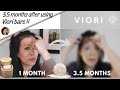 VIORI SHAMPOO & CONDITIONER BARS REVIEW⭐AFTER 3.5 MONTHS: HAIR GROWTH? MOLD? SUBSCRIPTION | PART 2