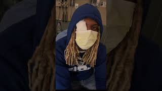 Lil Durk Almost Loses Eye 🤯 “ MUST WATCH “ #shorts #shortsvideo #rap #lildurk