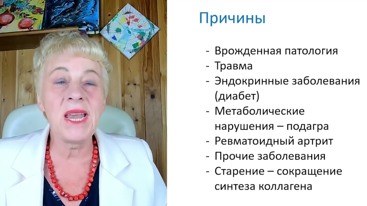 Возрастные проблемы суставов. Патология и уход за суставами