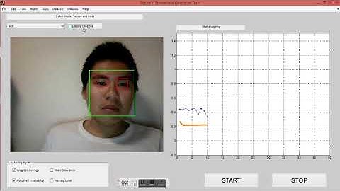 Drowsiness detection