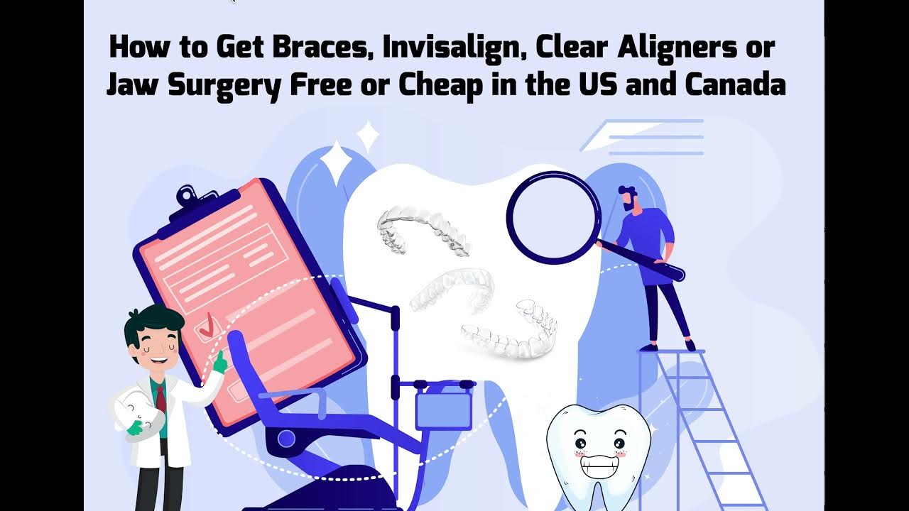 How to Get Braces Free or Cheap from a Dental School with Orthodontic Residence YouTube
