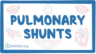 Pulmonary shunts