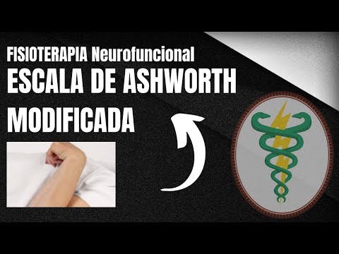 ESCALA DE ASHWORTH MODIFICADA | FISIOTERAPIA NEUROFUNCIONAL