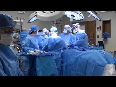 Mayo Clinic Minute Nipple Sparing Mastectomy Pre Pectoral Reconstruction
