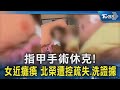 指甲手術休克! 女近癱瘓 北榮遭控疏失.洗證據｜TVBS新聞 @TVBSNEWS02