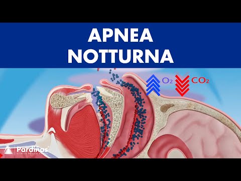 Apnea notturna ©