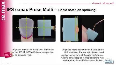 Introducing IPS e max® Press Multi