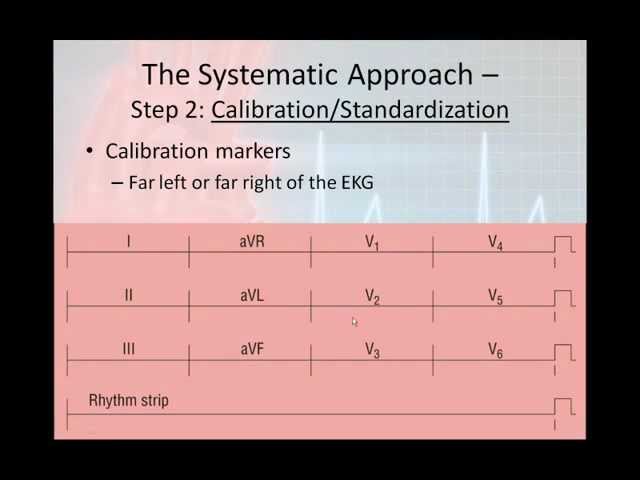12 Lead Interpretation Part 2 The 6 Step 12 Lead Interpretation Process Youtube