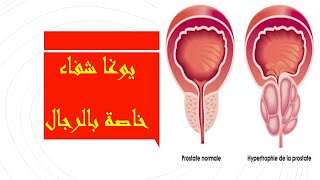 أفضل حركات اليوغا للوقاية من تضخم البروستات