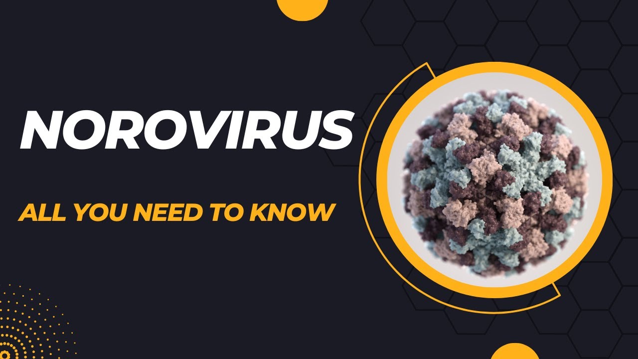 Uncovering the Mystery Behind Norovirus: 25 Must-Know Facts | Norovirus