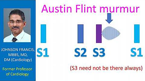 Austin Flint murmur