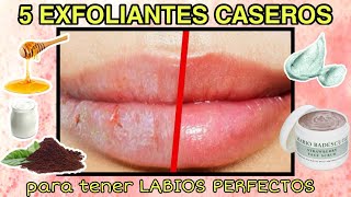 5 EXFOLIANTES CASEROS PARA LABIOS DAÑADOS || HIDRATA Y REPARA TUS LABIOS FÁCILMENTE || ISINAPIOLINA