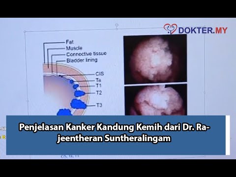 Gejala dan Rawatan Kanker Kandung Kemih / Bladder Cancer | Dr. Rajeentheran Suntheralingam