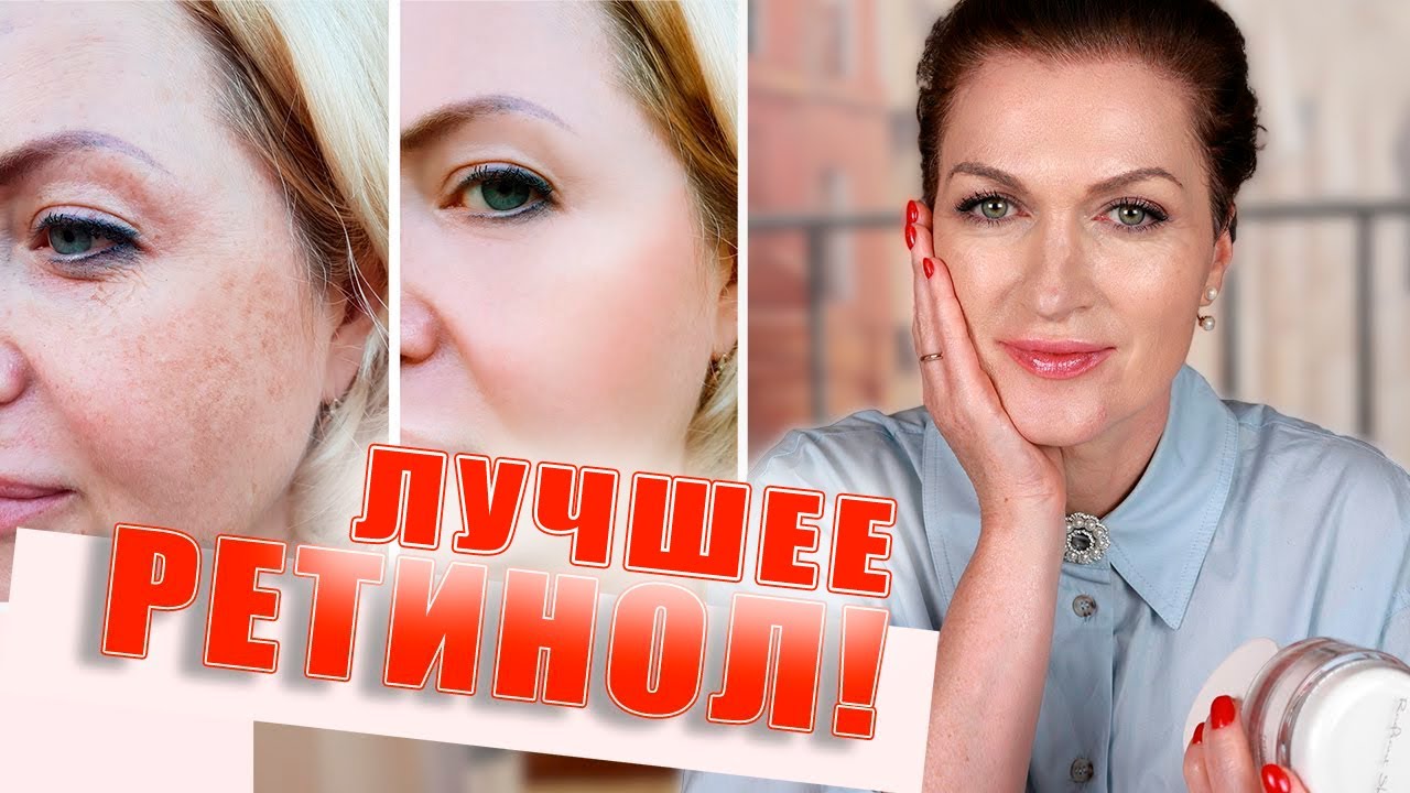 Убираем морщины и пигментацию! Ретинол: кремы, сыворотка лучшее!