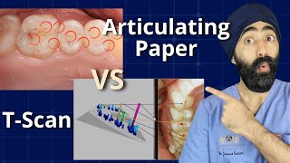 Articulating Paper is Lying To Us - Measuring the Occlusion Digitally with Force and Time - PDP109