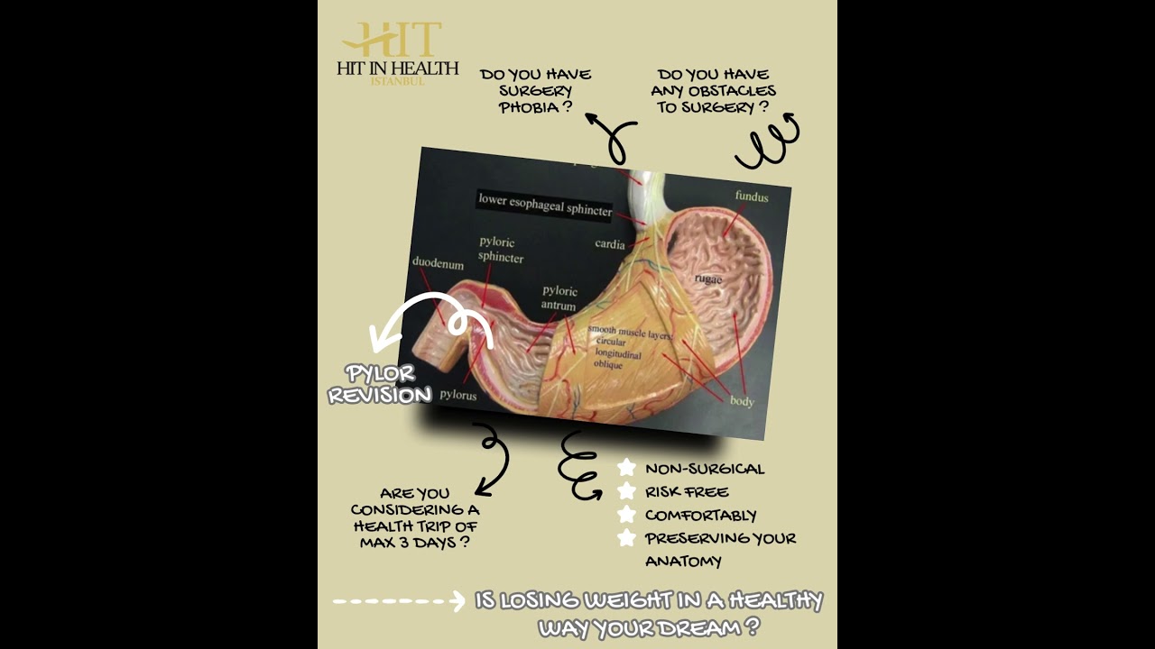 PYLOR REVİZYONU