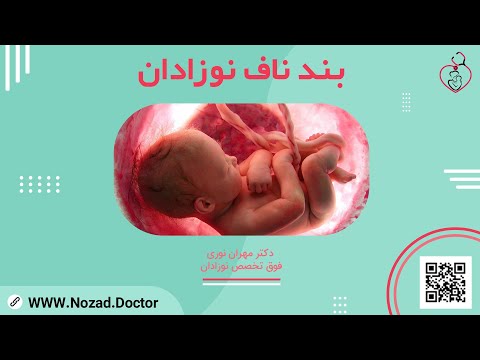 تصویری: آیا می توان نوزادی را با گرانولوم ناف حمام کرد؟